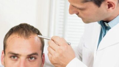 cheapest hair transplant cost in India